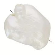 Perla d'acqua dolce barocca irregolare Keshi - da 10 a 14 mm - Grado AAA - Bianca x1